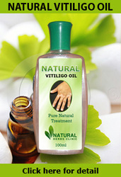Natural vitiligo treatment with Natural vitiligo oil