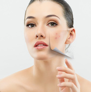 Revitol Rosacea Treatment
