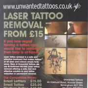Tattoo Removal Without Pain In Birmingham