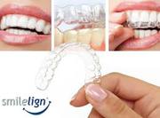 Smilelign Applies 3D Technology for Making Accurate Aligners