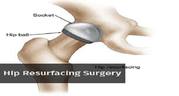 Get affordable Hip Resurfacing Surgery cost in India