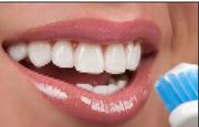 Good Dental Implants in Sutton