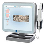 3d Digital dental impressions iTero scanner in Bluebell Dental Clinic