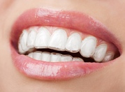 Smile Brightly and Confidently with Smilelign Aligners