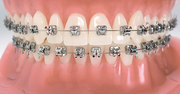 Transform Your Smile with Premium Orthodontic Treatment