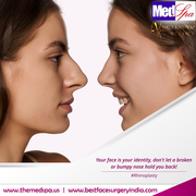 Rhinoplasty Surgery in Delhi