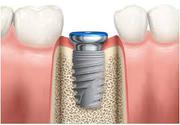 Endodontic Practice  Courses in UK.