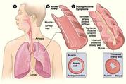 Asthma Specialist Near Me