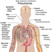 Chest infection specialist Manchester - Childlungclinic