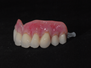 Denture Repair in Dorset from The Hive Dental Laboratory