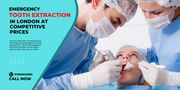 Emergency Tooth Extraction in London at Competitive Prices