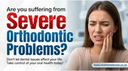 Are you suffering from Severe Orthodontic Problems?
